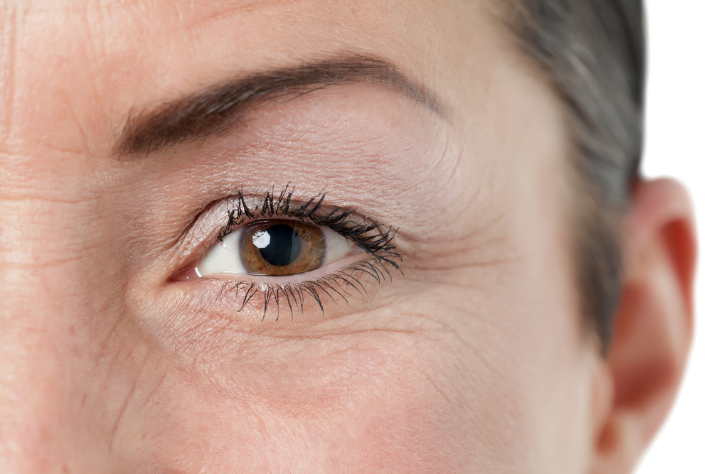 ThermiSmooth Treatment in Houston
