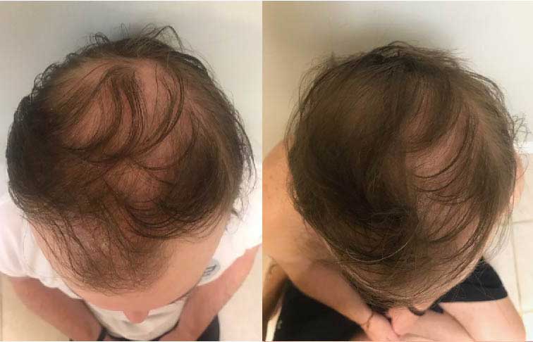 6 WEEKS