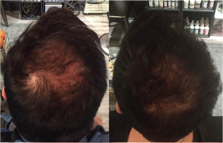 8 WEEKS