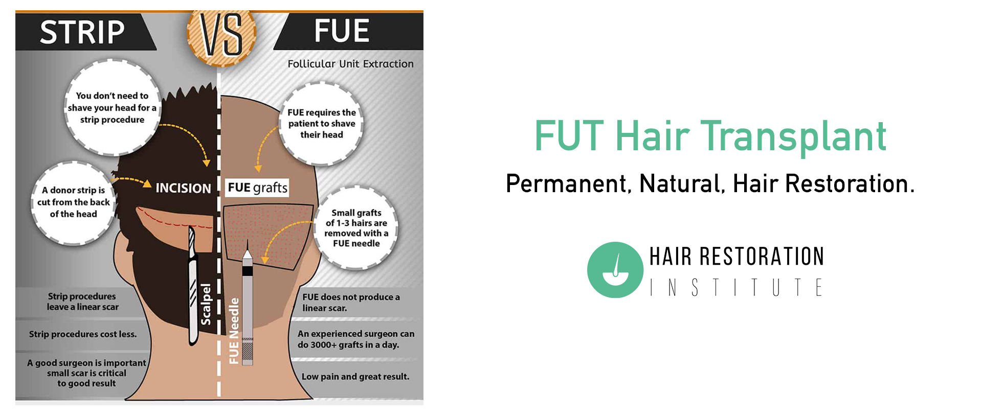 Advanced fut hair transplants dfw - Hair Restoration Institute Advanced fut hair transplants dfw - Hair Restoration Institute
