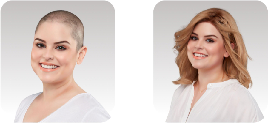Before & After