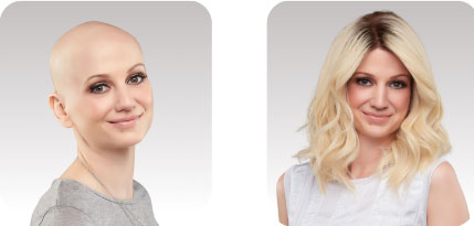Before & After