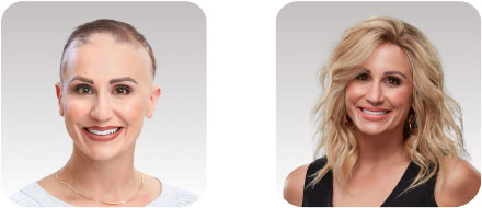 Before & After